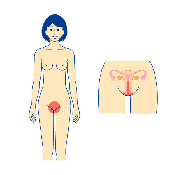 女性の主な症状