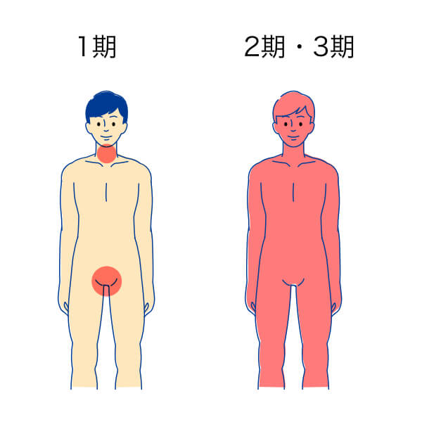 梅毒 男性