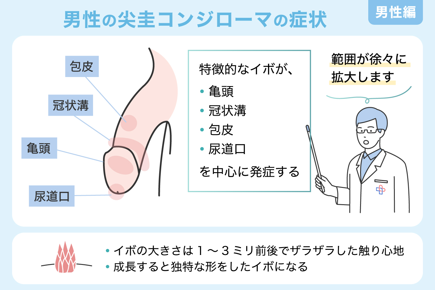 男性の尖圭コンジローマの症状