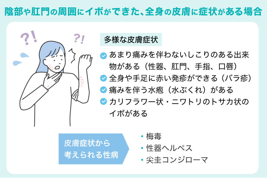 陰部や肛門の周囲にイボができた、全身の皮膚に症状がある場合