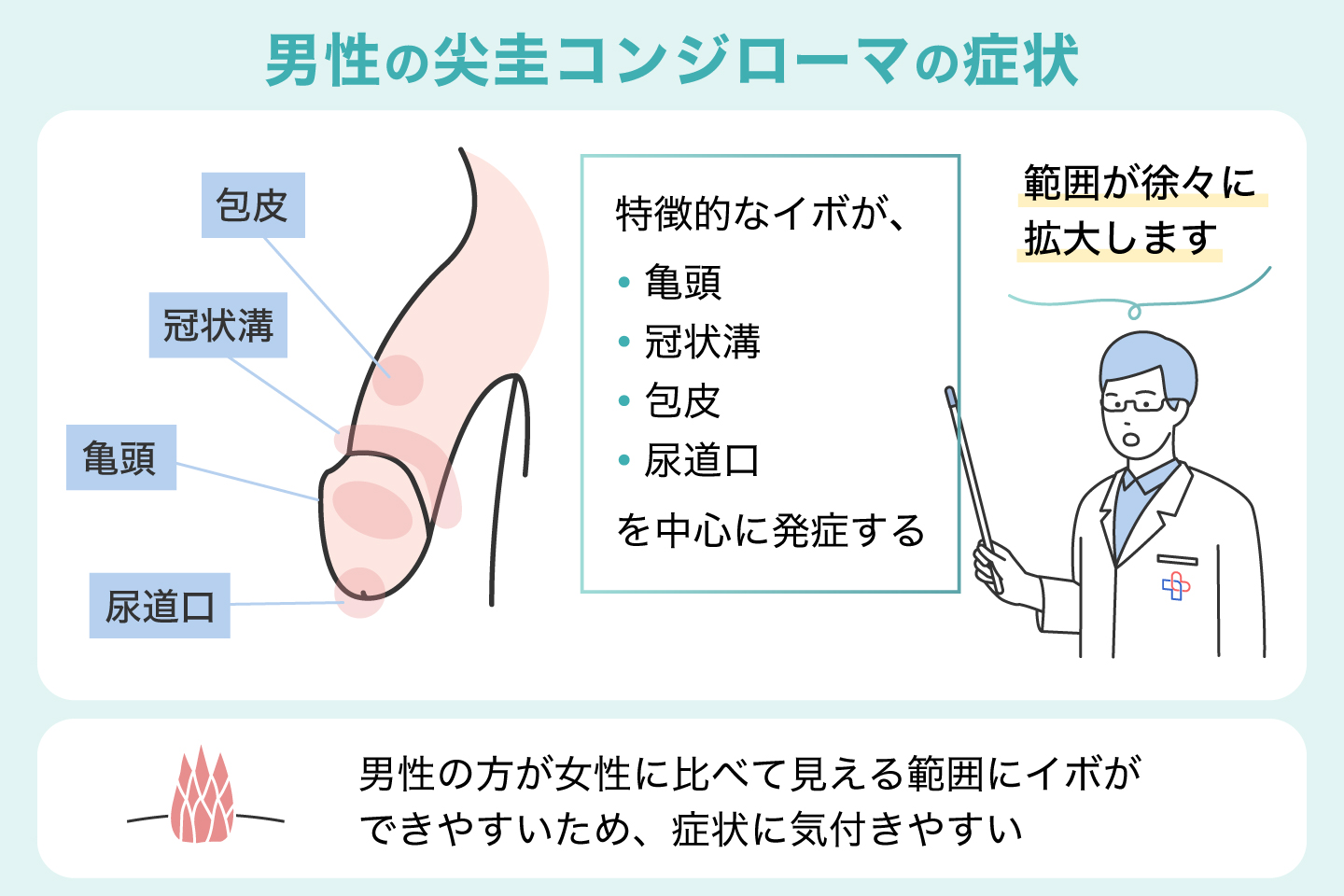 男性の尖圭コンジローマの症状