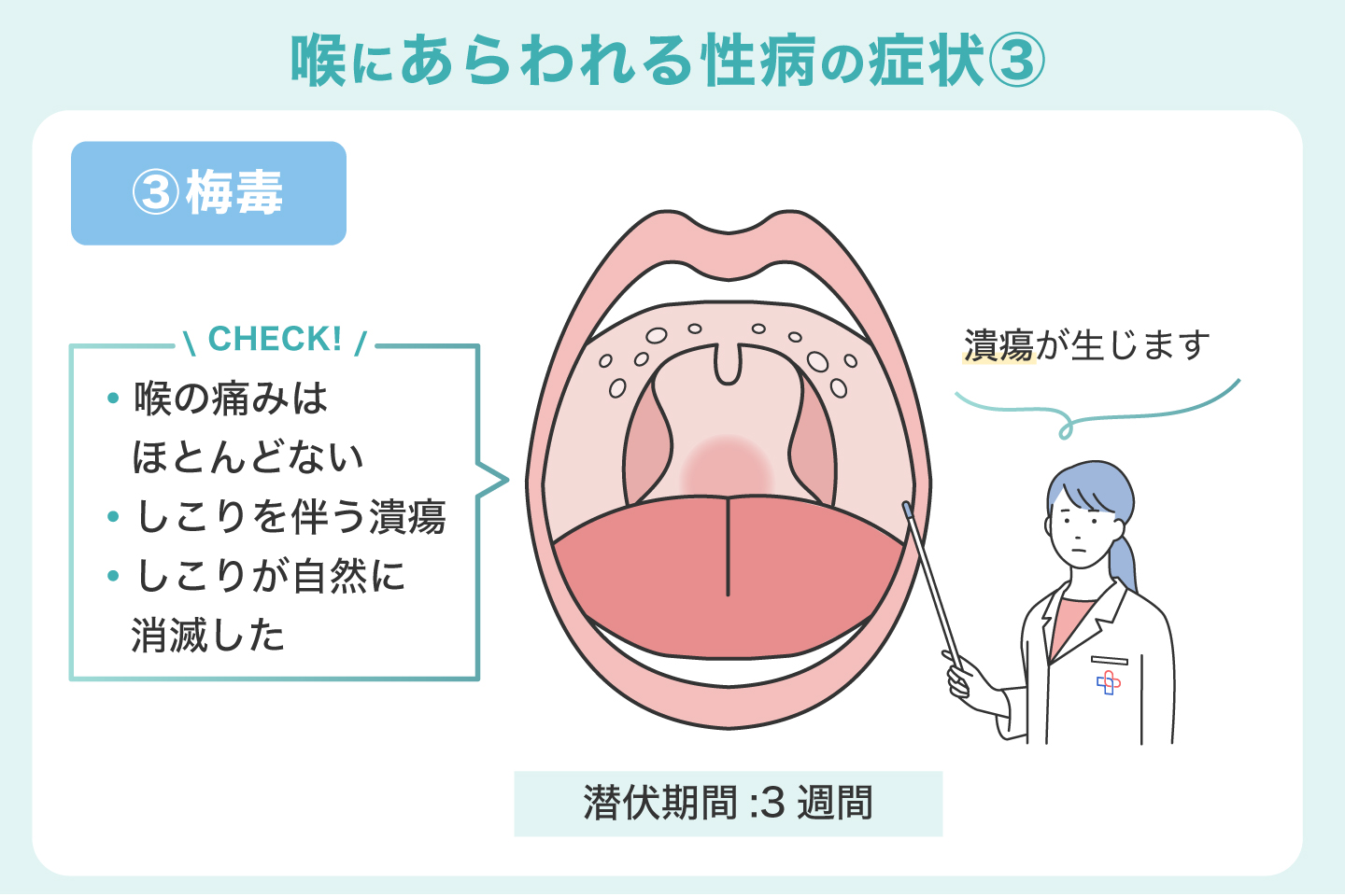 喉にしこりがあった場合にあらわれる性病の症状