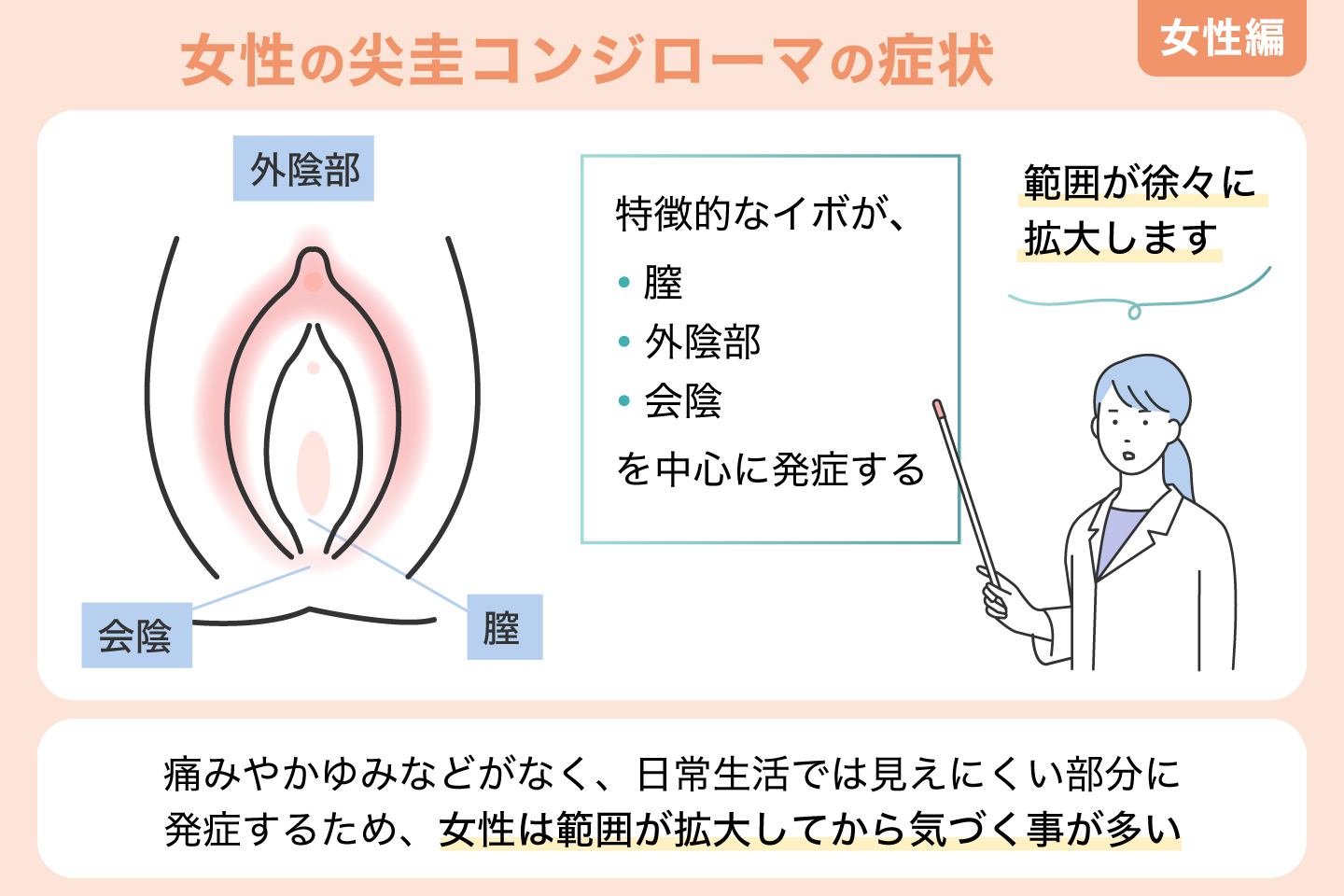 女性の尖圭コンジローマの症状