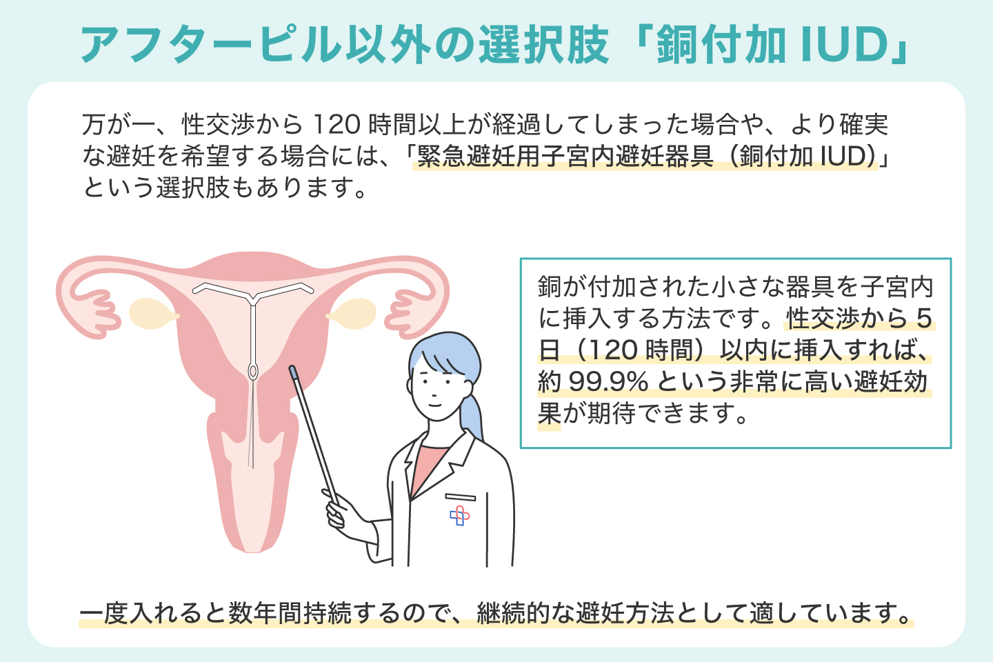 アフターピル以外の選択肢「銅付加IUD」